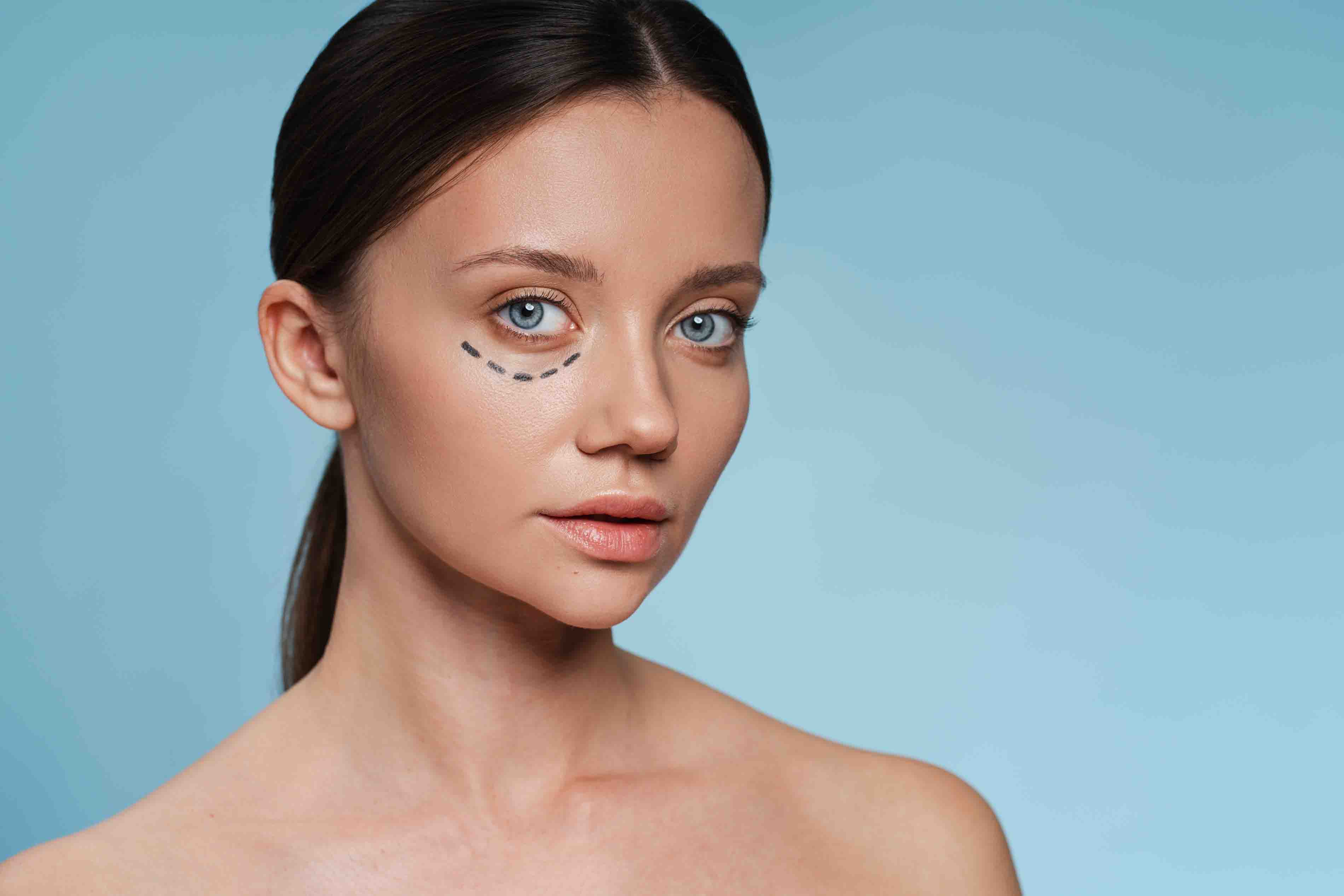 Blepharoplasty Eyelid Surgery Dubai