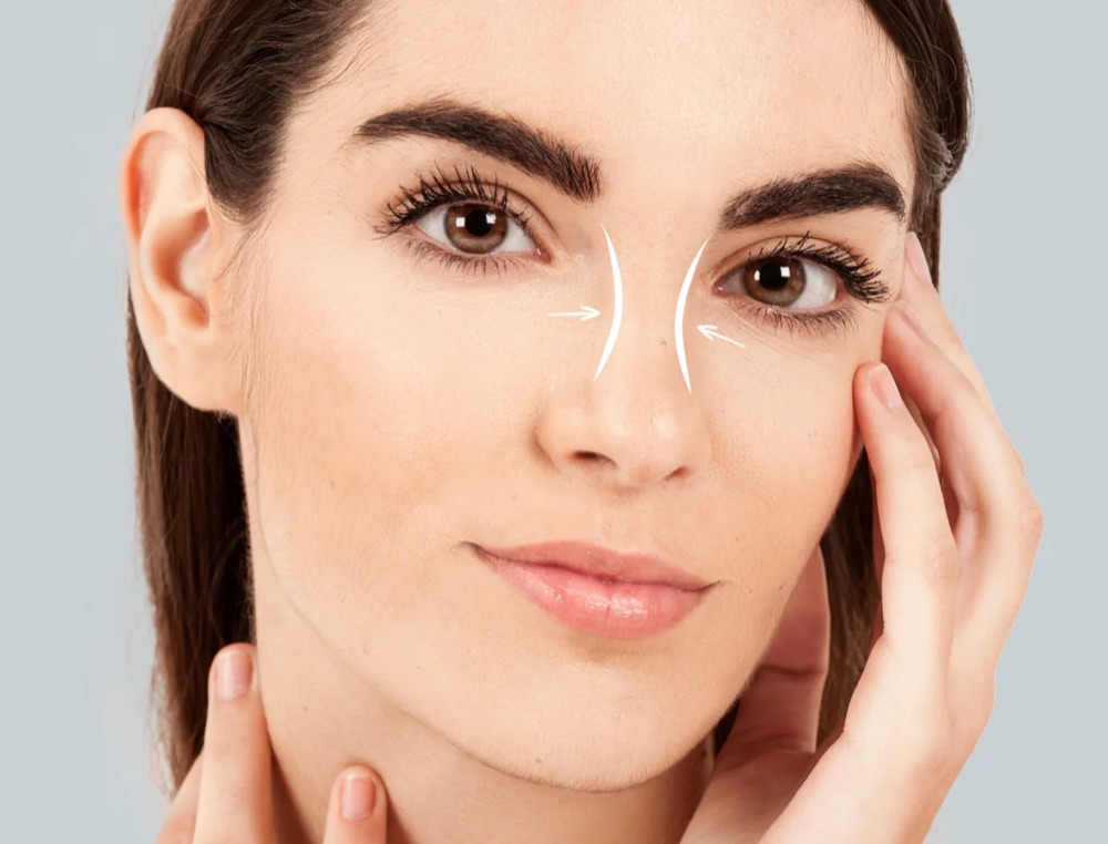 Rhinoplasty Nose Surgery Dubai