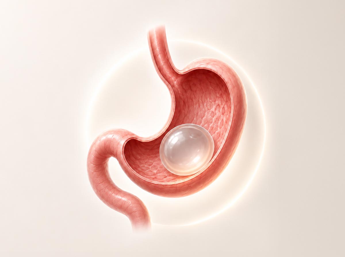 Gastric Balloon Dubai - Non-Surgical Endoscopic Weight Loss Procedure at Royal Villanova Center